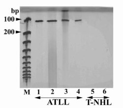 PCR