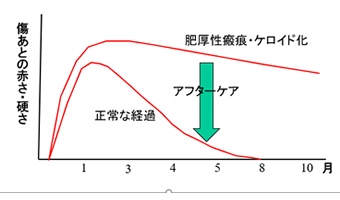 傷跡の経過