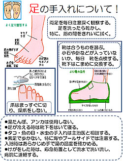 チェック表