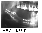 写真2