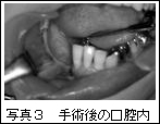 写真3