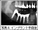 写真4