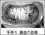 写真5