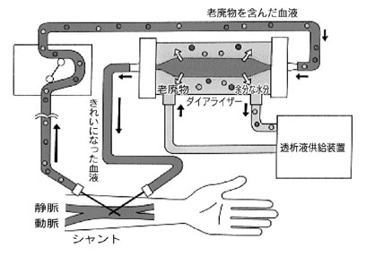 イラスト
