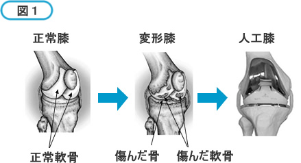 図1